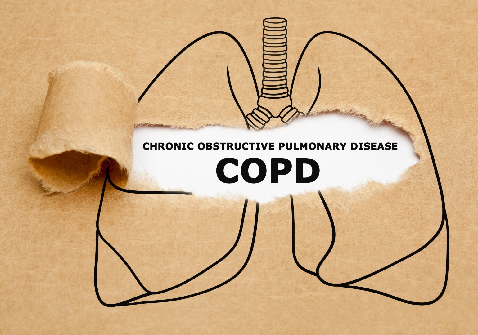 Image of a drawing of lungs being ripped open to show COPD
